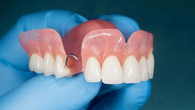 酶制劑——口腔健康守護者